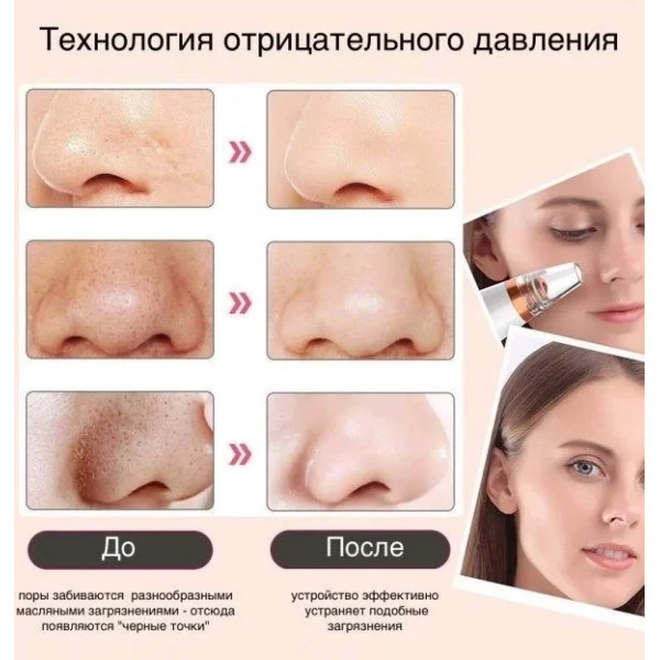Аппарат для глубокой вакуумной чистки пор лица Dermal Multi-Functional Cleaning