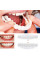 Знімні вініри Veneers, вініри для зубів, накладні зуби, накладки для зубів