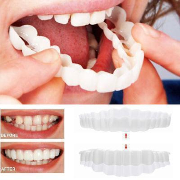 Знімні вініри Veneers, вініри для зубів, накладні зуби, накладки для зубів