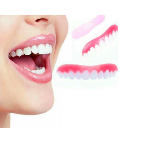 Знімні вініри Veneers, вініри для зубів, накладні зуби, накладки для зубів
