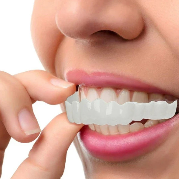 Знімні вініри Veneers, вініри для зубів, накладні зуби, накладки для зубів