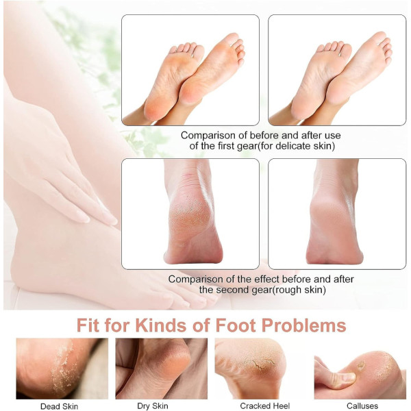 Электрическая пемза для пяток Flawless Pedi RD-9021 аккумуляторная, роликовая пила для удаления мозолей и огрубевшей кожи